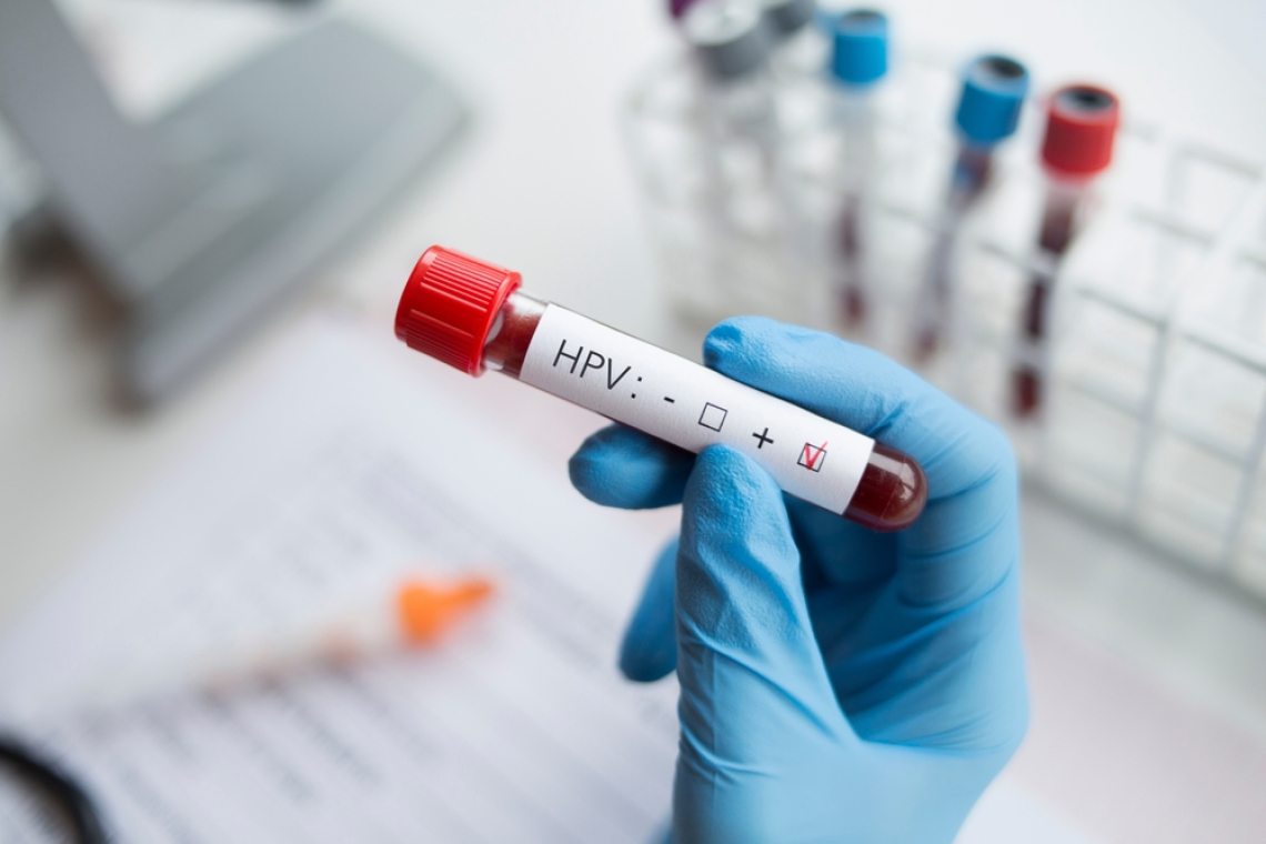HPV: virus, ki lahko povzroči šest vrst raka in ga lahko preprečimo